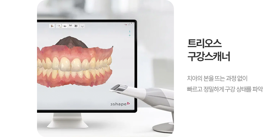 트리오스 구강스캐너 치아의 본을 뜨는 과정 없이 빠르고 정밀하게 구강 상태를 파악