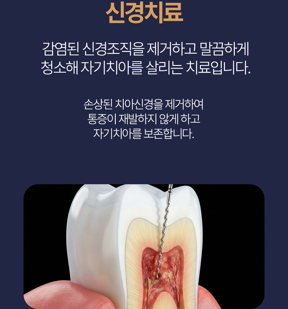 신경치료 감염된 신경조직을 제거하고 말끔하게 청소해 자연치아를 최대한 보호합니다. 손상된 치아신경을 제거하여 통증이 재발하지 않게 하고 자연치아를 최대한 보존합니다.