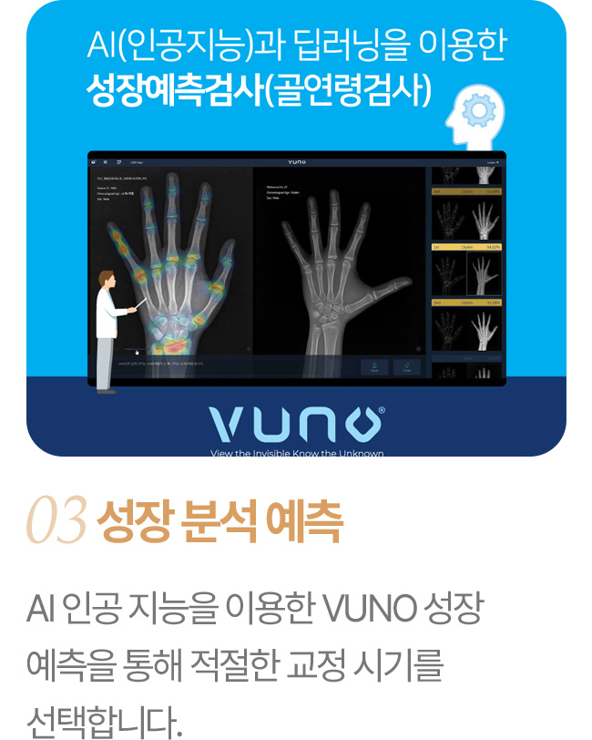 성장 분석 예측 AI(인공지능)과 딥러닝을 이용한 성장예측검사(골연령검사) AI 인공 지능을 이용한 VUNO 성장 예측을 통해 최적의 교정 시기를 선택합니다.
