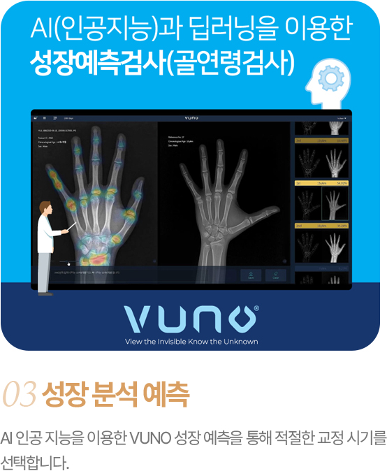 성장 분석 예측 AI(인공지능)과 딥러닝을 이용한 성장예측검사(골연령검사) AI 인공 지능을 이용한 VUNO 성장 예측을 통해 최적의 교정 시기를 선택합니다.